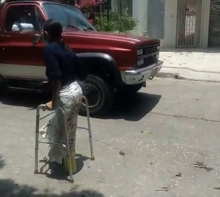 A pesar de este doloroso contexto, Ruth -que siempre pone por delante sus ganas de vivir- decidió construirse una prótesis casera
<b> con un tubo para desagüe y seguir caminando</b>, mientras se aguantaba el dolor a cada paso. 
<br>