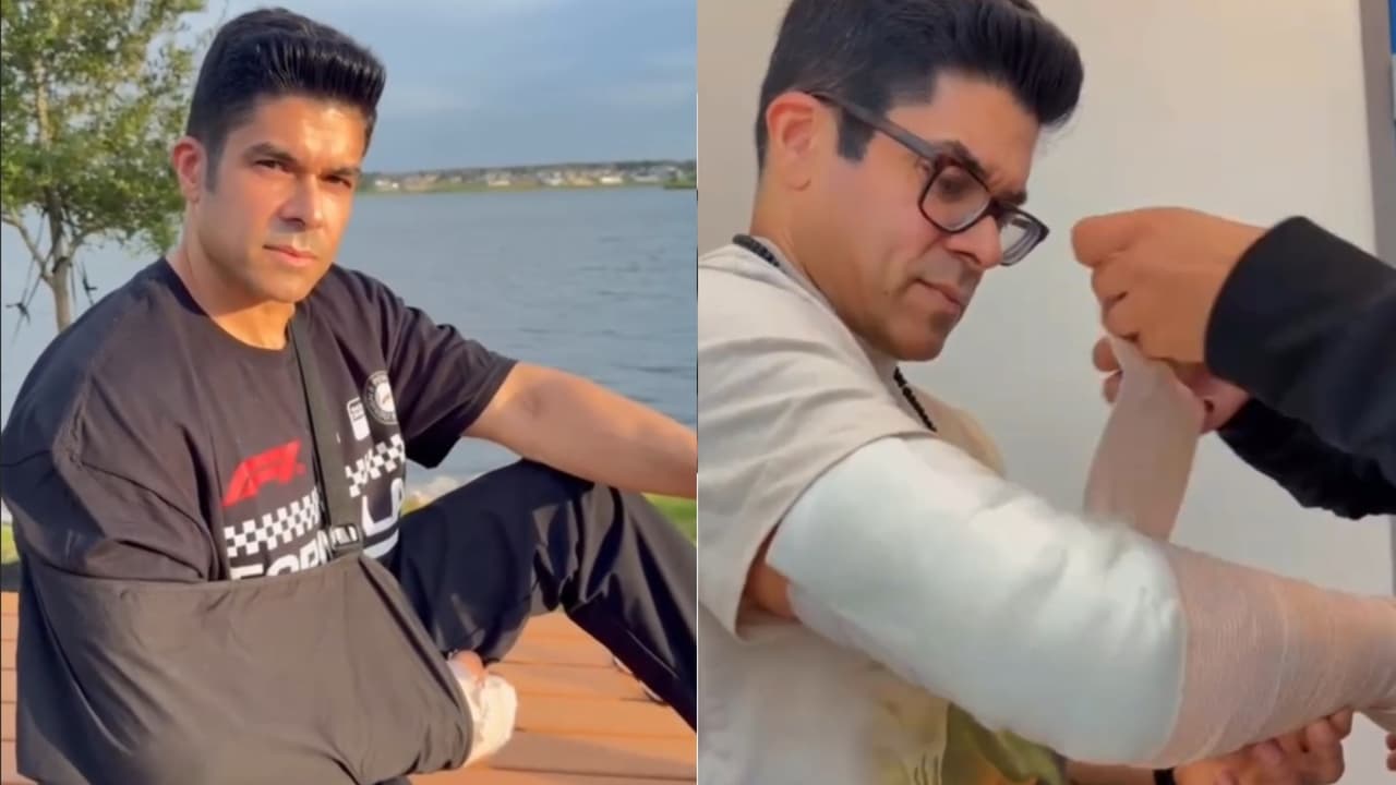 Jerry Rivera muestra cómo quedó su brazo tras su operación por fractura