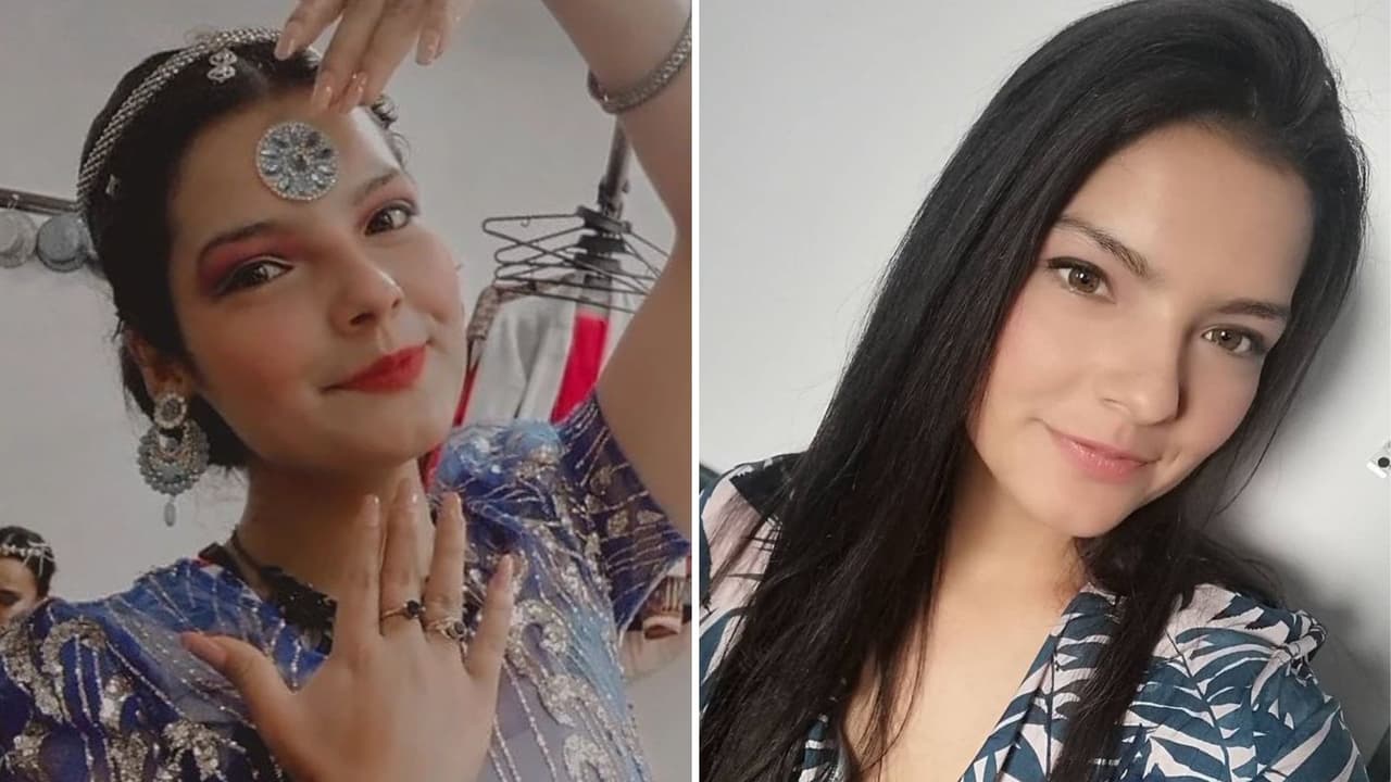 Actriz sufre graves quemaduras en restaurante: revelan impactantes imágenes