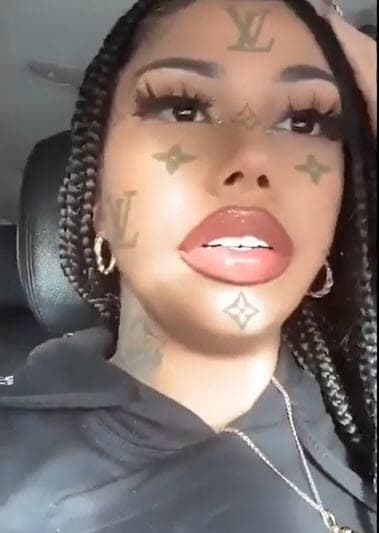 Al parecer, eso habría ayudado, pero el reporte es que la ex de Tekashi 6ix9ine aún tiene grandes secuelas. 
<b>"Ni siquiera puede acostarse"</b>, mencionan los informantes.
<br>