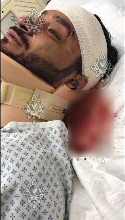 Aún con collarín en el cuello y con algunas dificultades para hablar, narró lo que vivió y cómo libró a la muerte. 
<br>