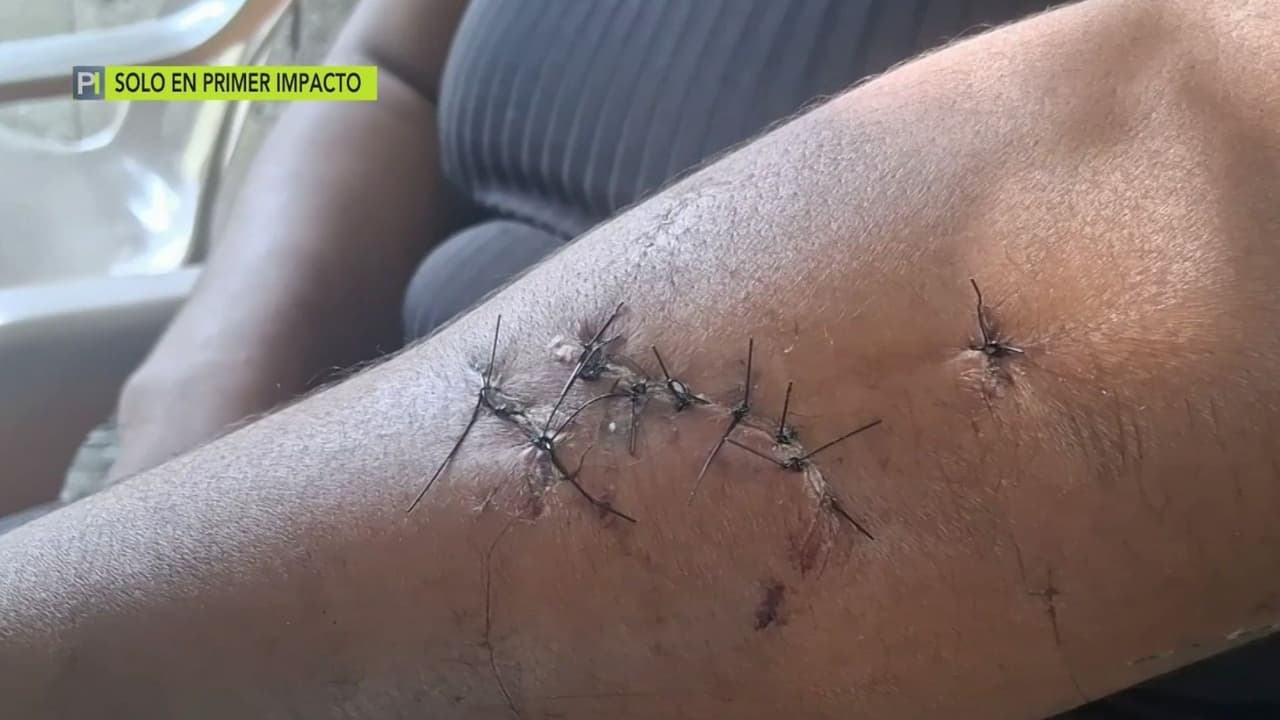 Una madre de familia es agredida con 26 puñaladas y sobrevive para contarlo; así fue como logró salir viva del ataque