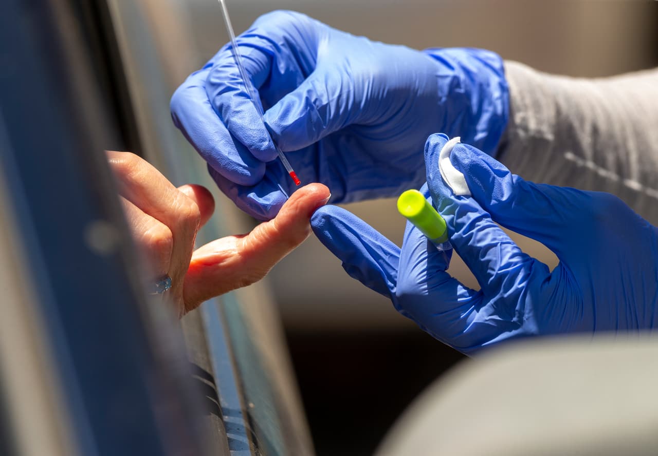 De acuerdo con la información estatal, en California hasta el 19 de mayo se registraron 1,466,733 pruebas de coronavirus y a la misma fecha se reportaron más de 45 mil pruebas más a la espera de resultados.