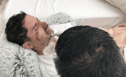 En diciembre pasado, el intérprete de 'El Baleado'
<b> tuvo un aparatoso accidente</b> cuando iba en su bicicleta y se lesionó gravemente la cara.
<br>