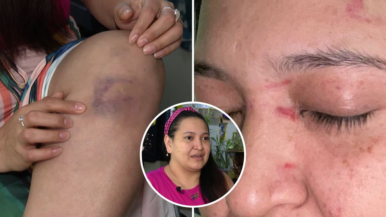 Hispana narra ataque que sufrió a manos de jovencitas en una estación del subway en NY