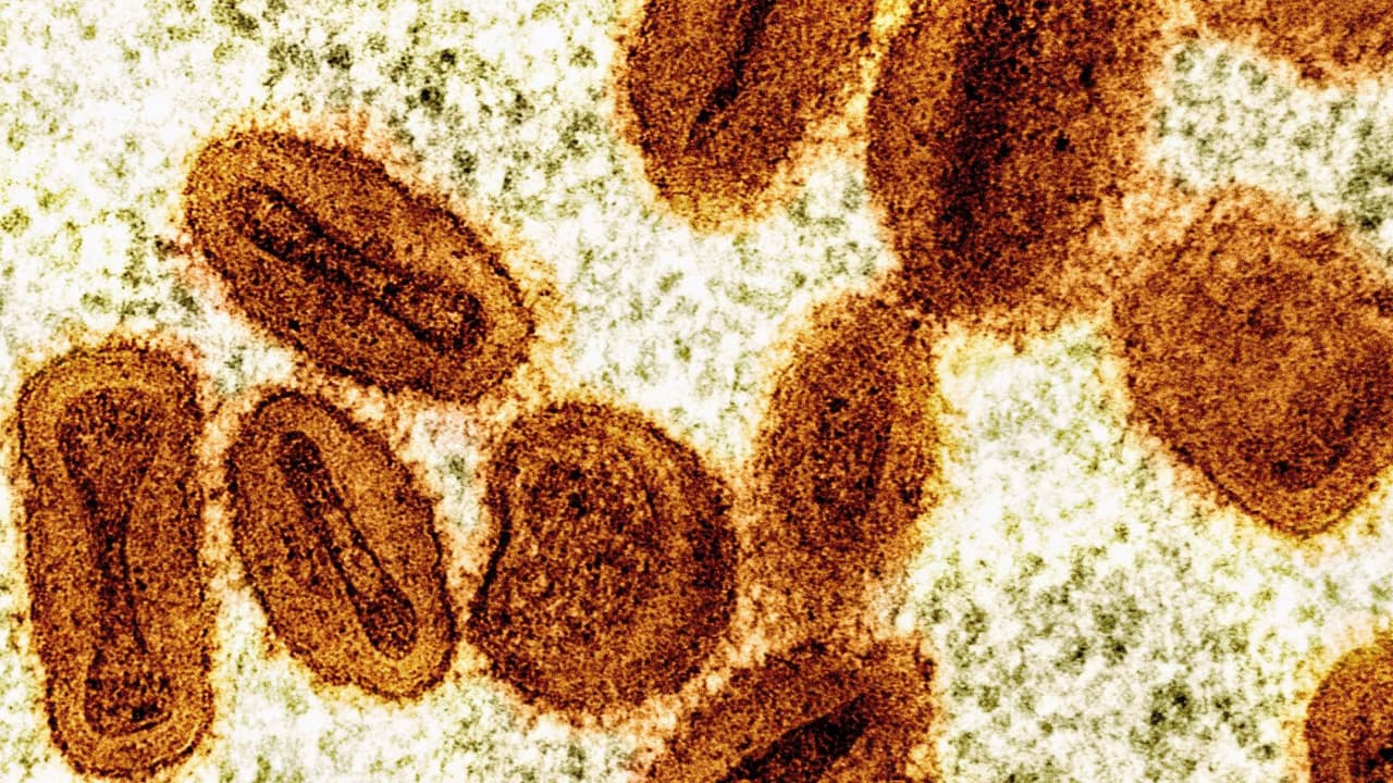 Confirman primer caso de Mpox del tipo Clado I asociado a viajes en Arizona: Lo que debes saber