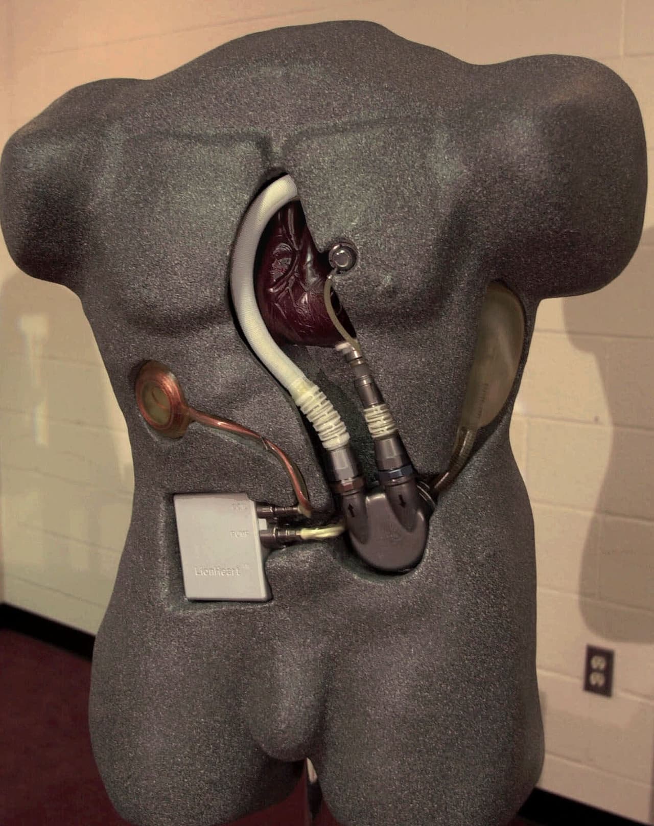 Según los expertos, esto se debe a varios factores y no solo a discriminación. Por ejemplo, puede que la persona se niegue a ponerse el aparato o que su historia clínica no lo permita.