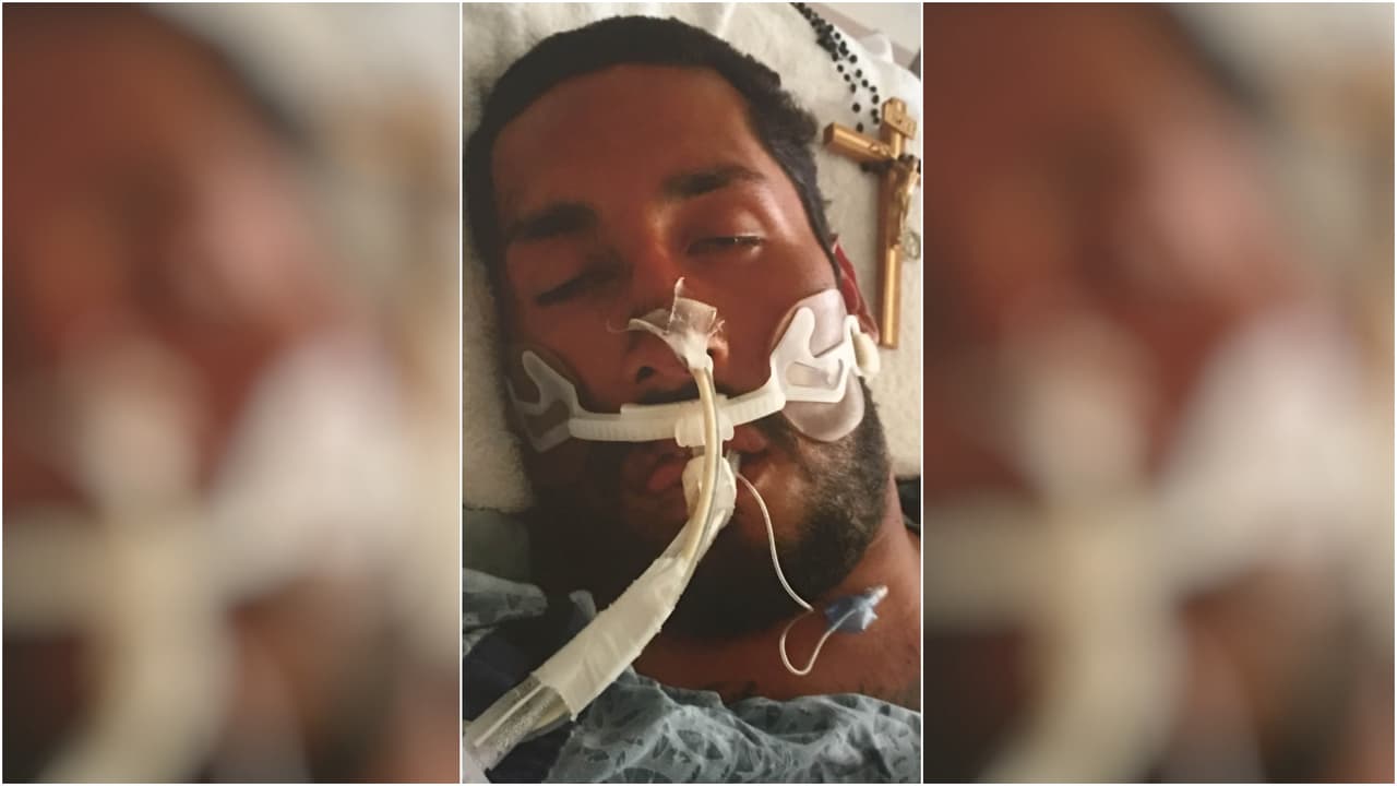 Estuvo en coma inducido por varios días.