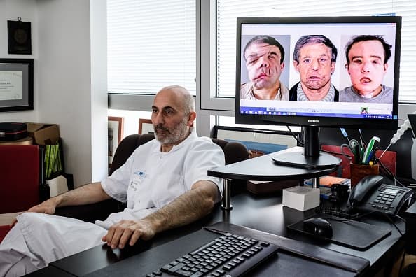 TOPSHOT - French medicine professor Laurent Lantieri, a specialist in hand and face transplant, poses next to a screen showing different steps of his patient Jerome Hamon's surgery on April 13, 2018 at the Hopital Europeen Georges-Pompidou in Paris. Hamon is the first man in the world to twice undergo a face transplant after flu tablets incompatible with his anti-rejection treatment led to the first attempt to fail. / AFP PHOTO / Philippe LOPEZ (Photo credit should read PHILIPPE LOPEZ/AFP/Getty Images)
