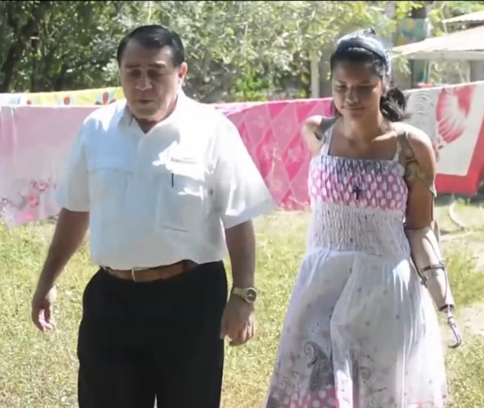 A pesar de este panorama cuesta arriba, Karla brilla por su interminable optimismo
<b> que termina contagiando a quienes la rodean.</b> Tal como hizo con una de sus maestras de bachillerato, la cual se acercó al diputado Reynaldo Carballo, quien quedó impresionado con su historia. 
<br>