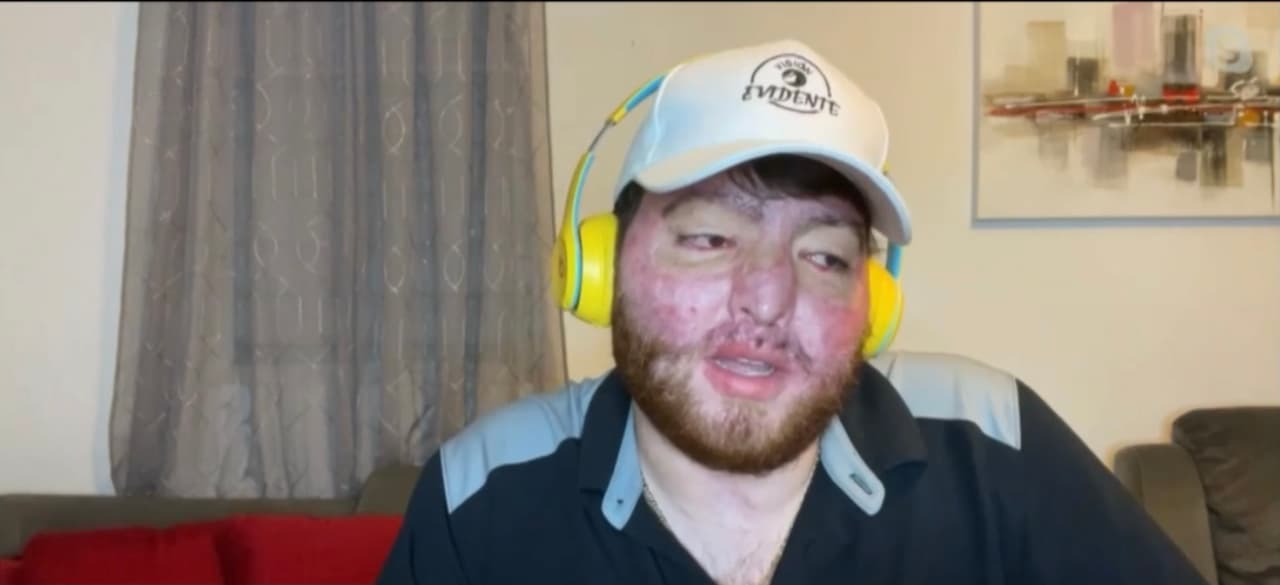 “Al leerla me quedé en 
<i>shock</i>, pero mantuve la calma porque sabía que tenía la cobertura de mi seguro. Así que empecé a realizar
<b> las gestiones correspondientes para poder saldar la deuda”</b>, recuerda Hernández. 
<br>