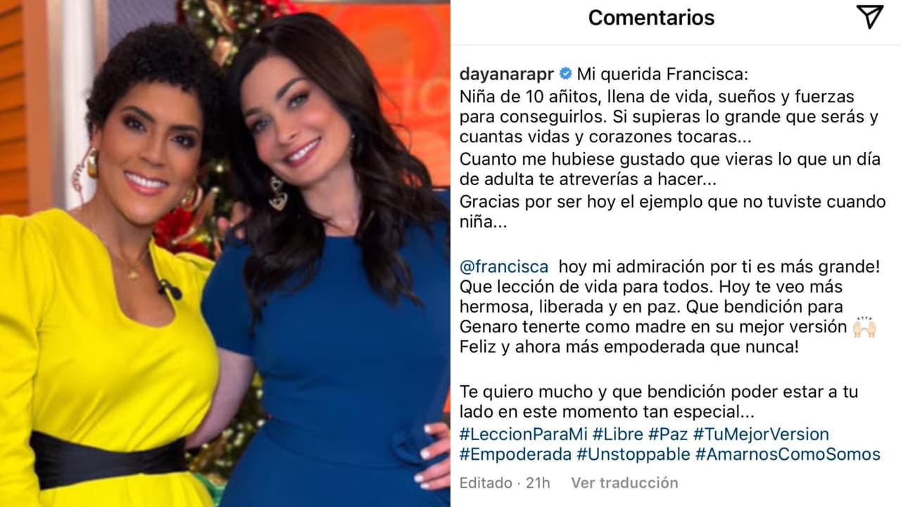 El indicio vino en el 
<b>mensaje de agradecimiento que le dejó a Dayanara Torres</b> en Instagram, quien aplaudió la valentía que tuvo para encarar en vivo y en televisión a uno de sus más grandes complejos. 
<br>