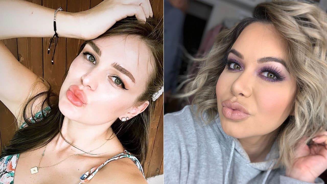 Y es que últimamente sí se le han visto más notorios que antes, al igual que a 
<b>Chiquis Rivera</b>, aunque ella asegura que eso se debe a una alergia nada más.