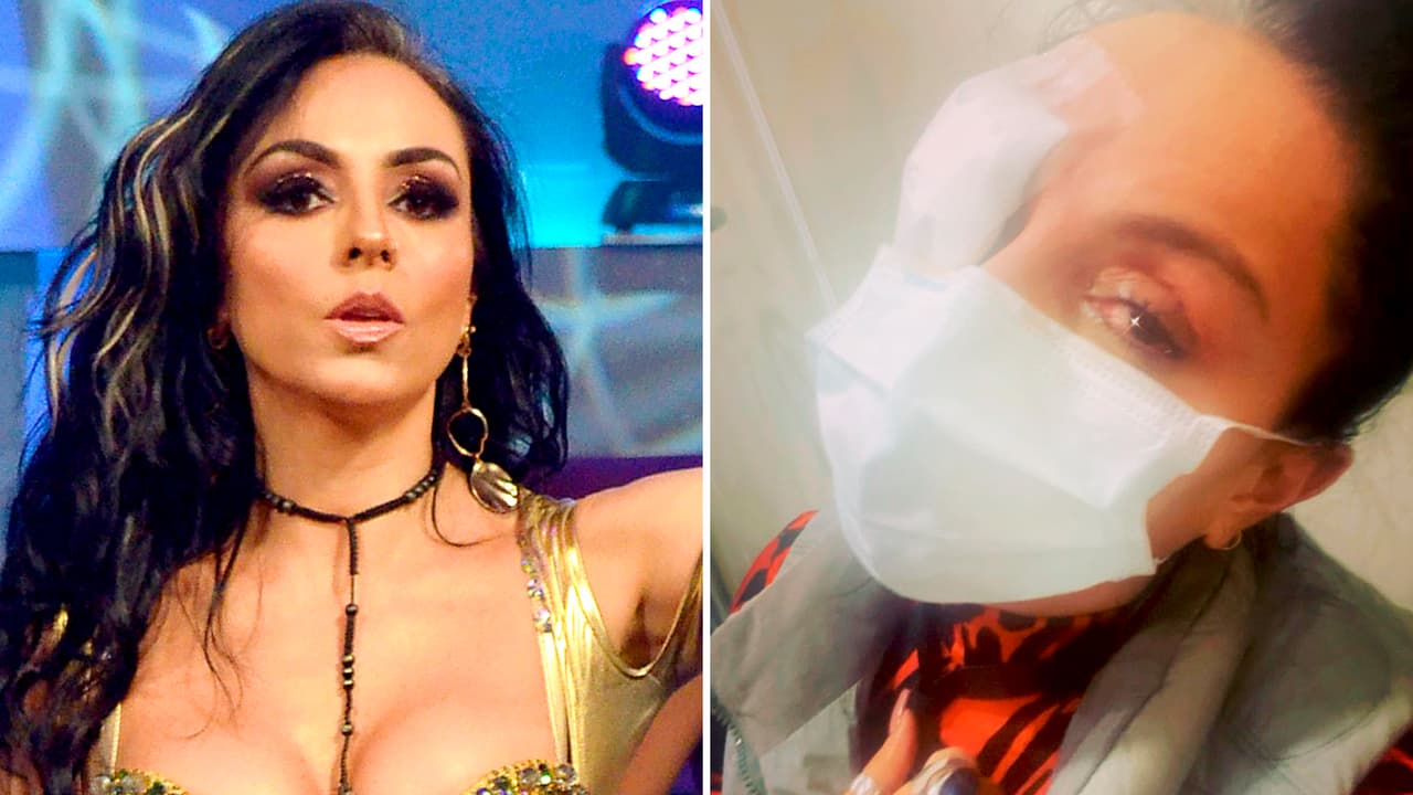 Ivonne Montero estalla contra quienes le dicen que se quemó las córneas por "vanidosa"
