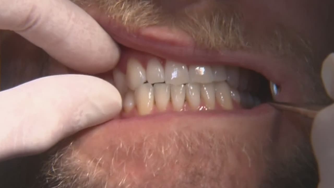 Medi-Cal ofrece cobertura de salud dental para niños y adultos, ¿qué procedimientos incluye?