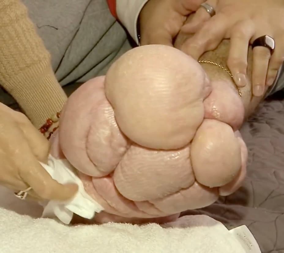 “La verdad dan muchas ganas de llorar y gritar”, dice Mejía al analizar su situación, mientras intenta hacer pequeños trabajos con los que apenas alcanza con los gastos mínimos. 
<b>Para poder ayudar a esta familia para que puedan volver a tener acceso a una realidad digna, favor de comunicarse al teléfono 305 471 4219.</b>
<br>