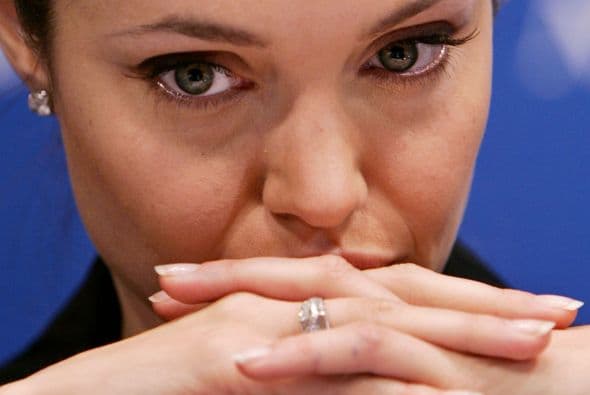 Angelina Jolie se sometió a una cirugía para extirparse ambos senos a fin de evitar el riesgo de contraer cáncer de seno, ante las altas posibilidades de padecer este mal por causas genéticas. Ver toda la información