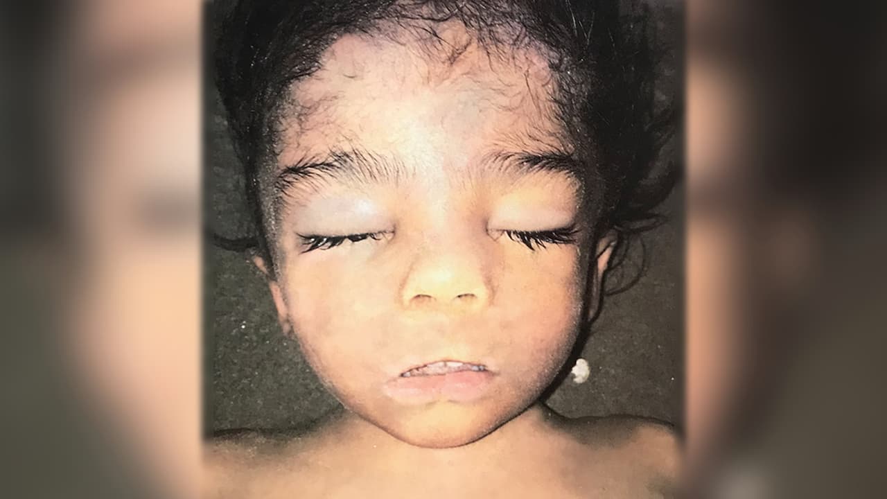 El menor, de entre 3 a 5 años, no murió ahogado, según el reporte forense.