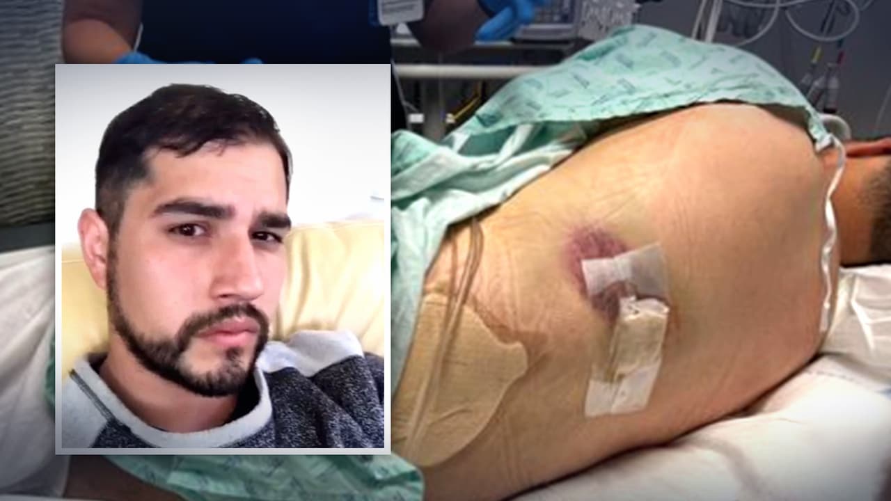 Artista hispano de Dallas fue baleado mientras hacía ejercicio en un sendero público