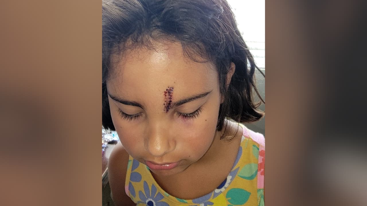 Niña de 8 años herida por un celular que le cayó en Six Flags Magic Mountain