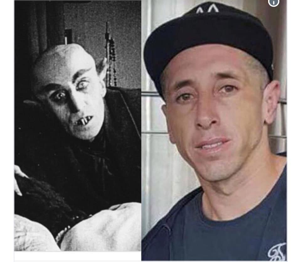 Y aprovechó el estar bajo anestesia para hacerse también otros 'arreglitos'.