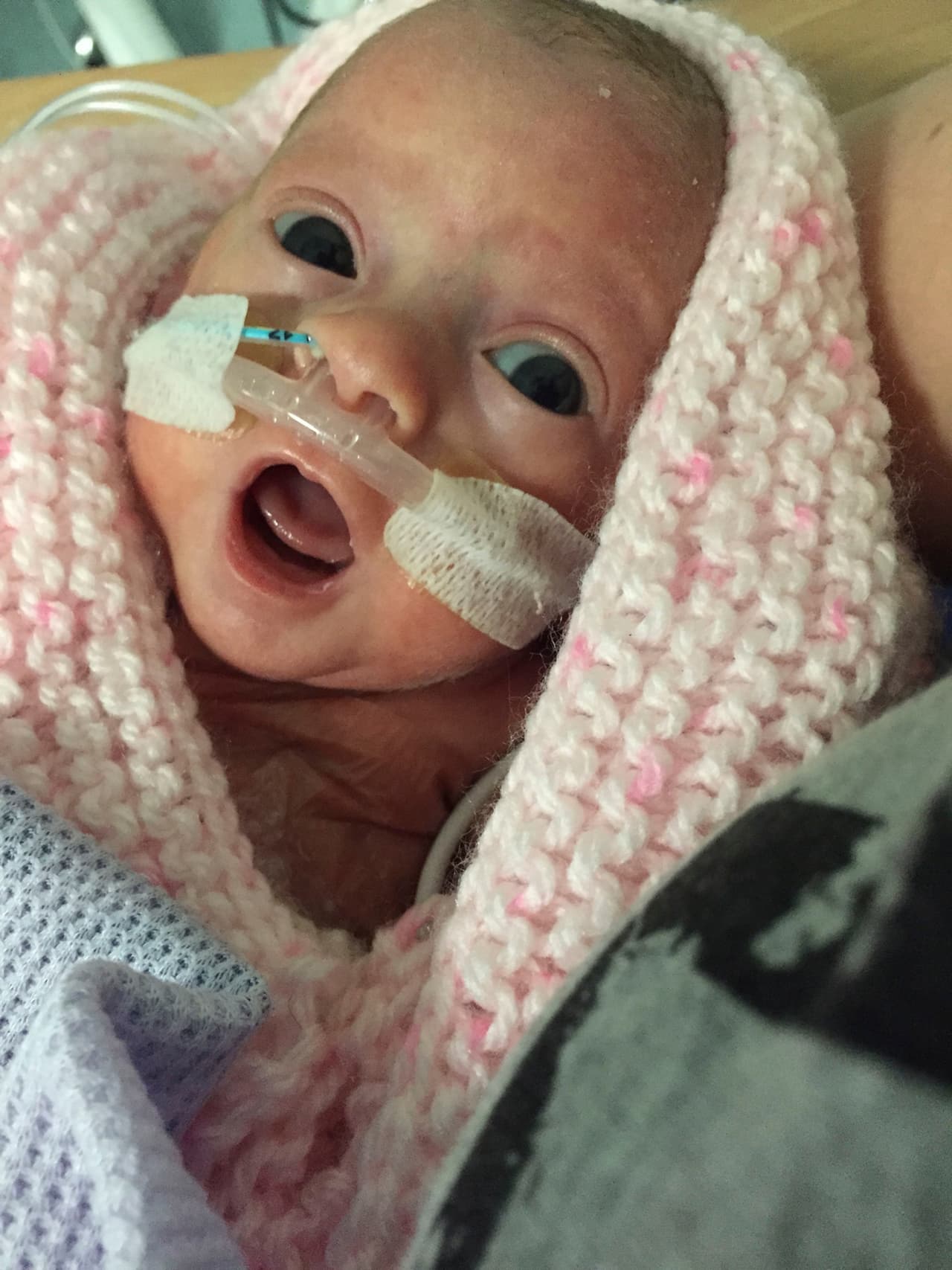 Los doctores advirtieron a su mamá, Vicki, de 20 años.