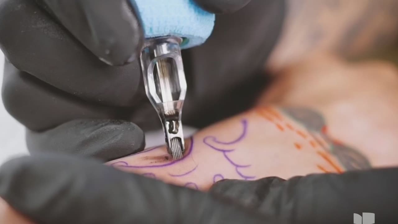 Tatuajes en quirófano bajo anestesia general: Empresa en Miami asegura ser la primera en ofrecerlos
