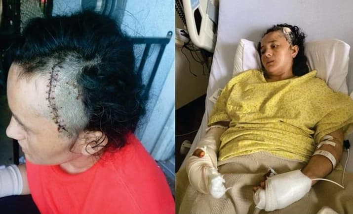 Hispano con colapso mental agrede con un machete a su esposa e hija