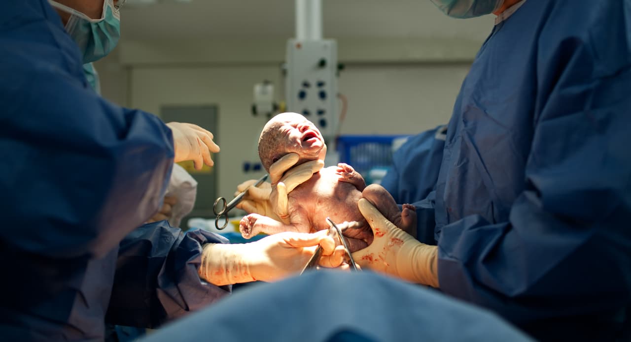 Un bebé de Florida nació dos veces después de ser diagnosticado a las 19 semanas de gestación con el síndrome CHAOS, un padecimiento que afecta a uno de cada 50 mil bebés y que en uno de cada 100 mil nacimientos es mortal
