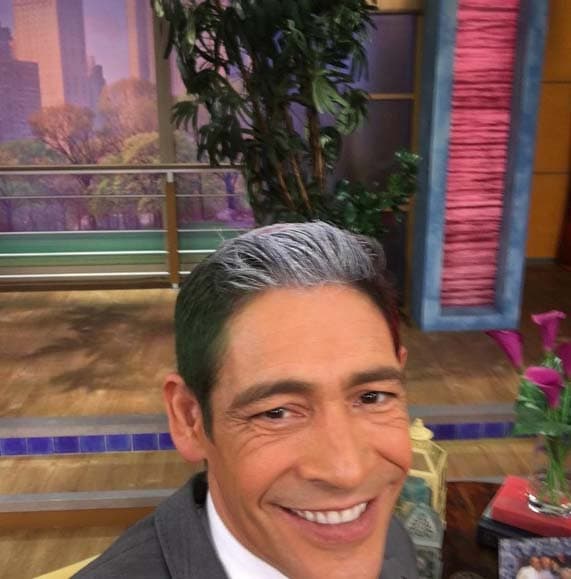 Quien sí recurrió a la toxina botulínica para combatir el paso del tiempo fue
<b>Johnny Lozada</b>. En enero del 2016 incluso mostró cómo fue su procedimiento en una transmisión de Despierta América, ¿lo recuerdas?