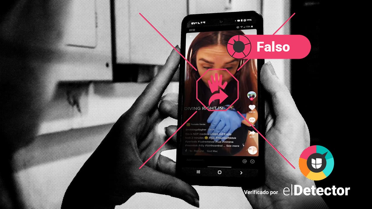 Es falso que quitarte el DIU por tu cuenta “es más fácil de lo que piensas”: verificamos la última viralidad de TikTok
