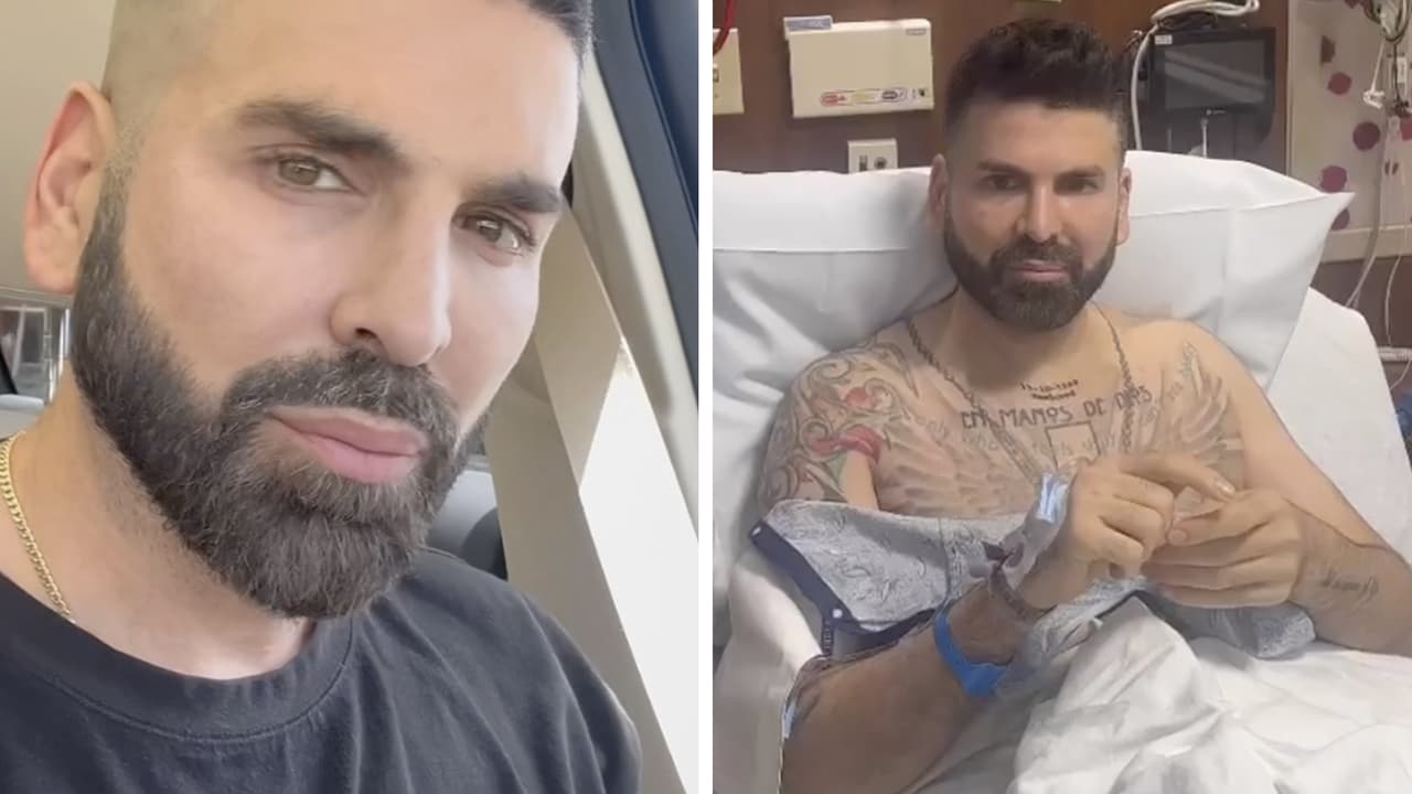 Jomari Goyso muestra con humor cómo sigue su pie tras el accidente: "Parece una pezuña de tocino"