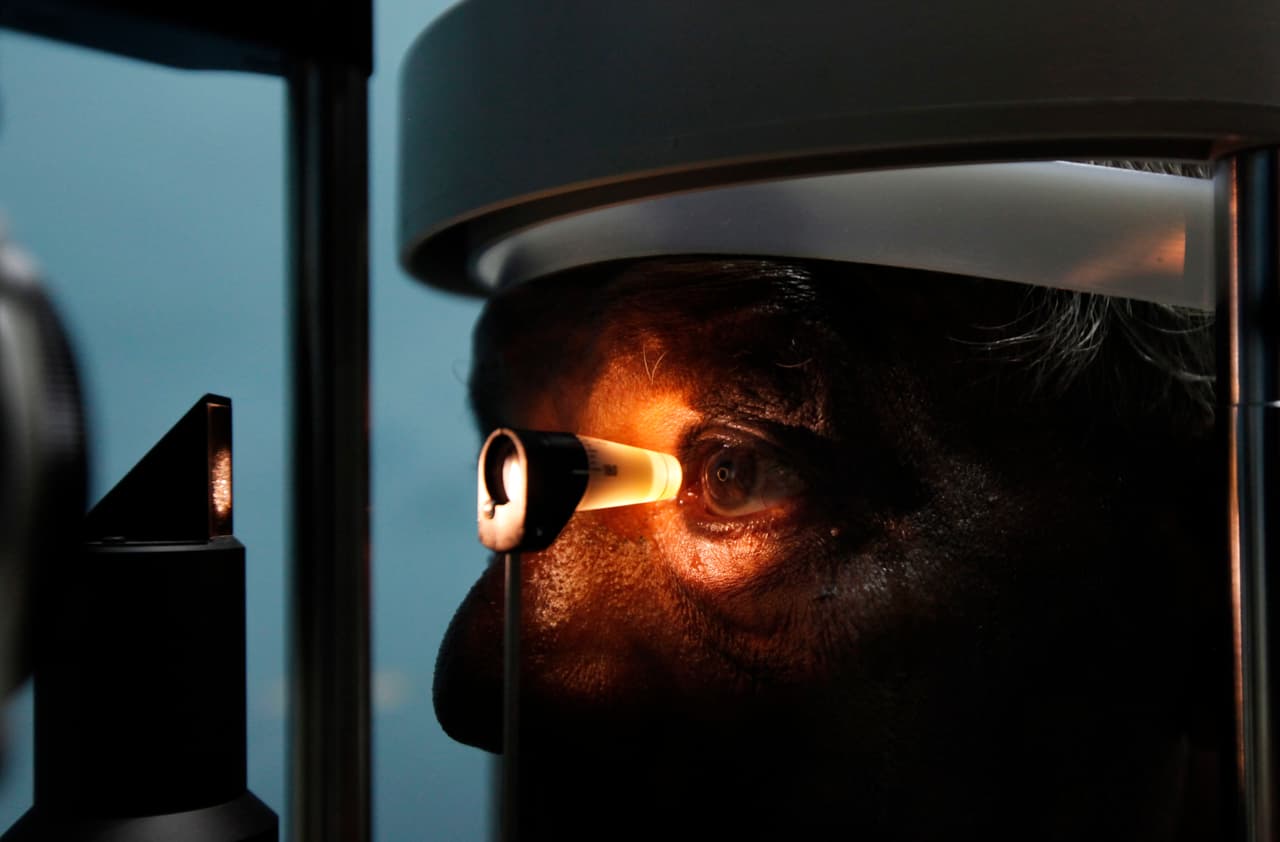 Paciente recupera la visión tras someterse al primer implante de una córnea artificial