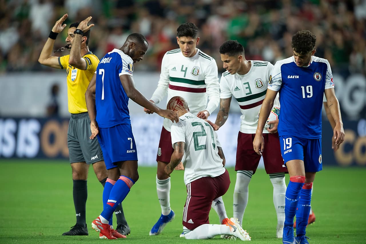 Y en una jugada completamente accidental, el zaguero mexicano Luis Rodríguez acabó con una herida en la cabeza.