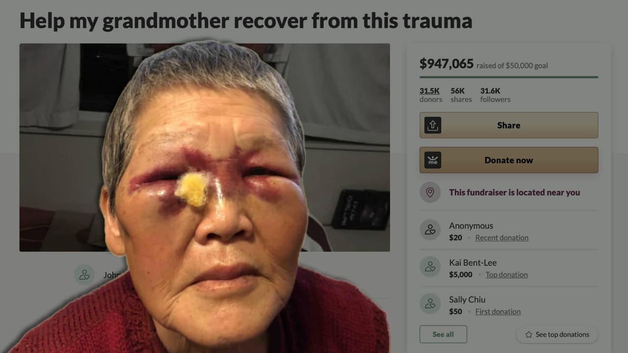 Abuela asiática atacada en San Francisco donará $950,000 que recibió en donaciones