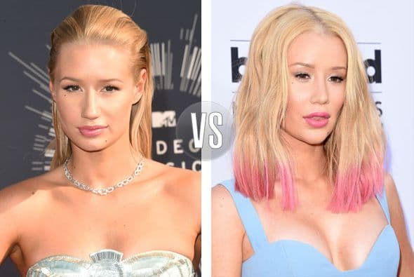 Iggy Azalea se unió a la lista de estrellas con la nariz operada.