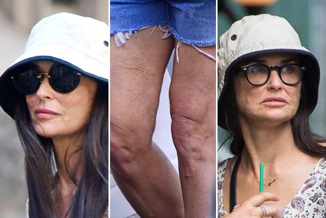 Una imágenes muestran lo mal y demacrados que aparecen su rostro y piernas.