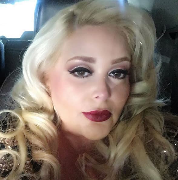 “(El doctor) Me comentó que sí necesitaba la operación, pues notó que no respiraba bien. No era algo que tenía planeado. También le mostré fotos, en donde mi nariz era aguileña, y cuando me reía se bajaba mucho. Entonces, con un programa de computadora vi cómo quedaría, y me pareció bien” explicó.
<br>