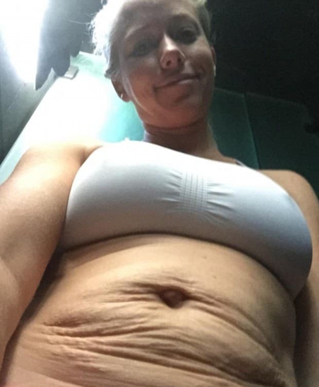 Pero a la modelo esto no le preocupa. Esta foto la compartió meses atrás, mostrando las marcas que le dejaron sus dos embarazos. Estrías que no la acomplejan en absoluto.