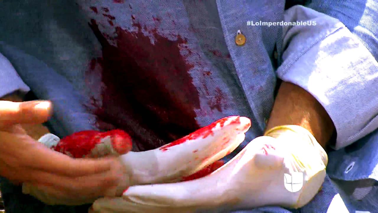 ¡La herida de Martín se abrió nuevamente!