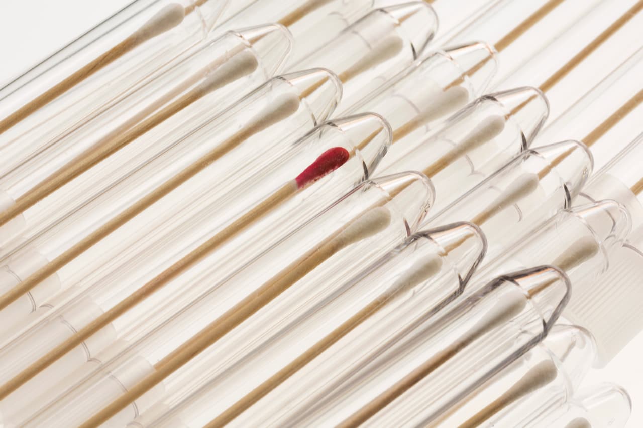 Con el test aprobado por la FDA se facilita la detección del virus.