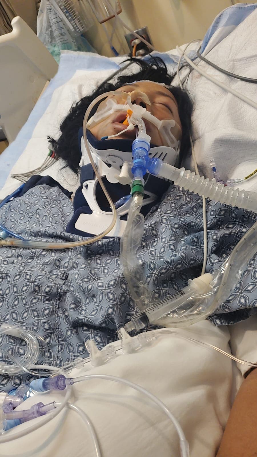 “Así está todavía ella ahorita”, dijo el padre de Marlén. “Esa foto que usted vio como estaba en el hospital, así está todavía. Se ve muy triste”.