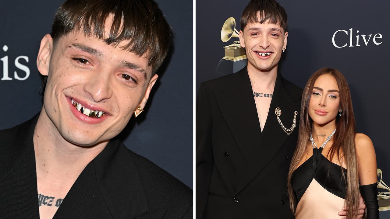 ¿Qué le pasó a Peso Pluma en los dientes? El ganador del GRAMMY causó revuelo con su look
