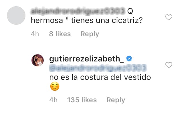 Sus seguidores comenzaron a cuestionarla por la supuesta cicatriz que tiene en la piel.