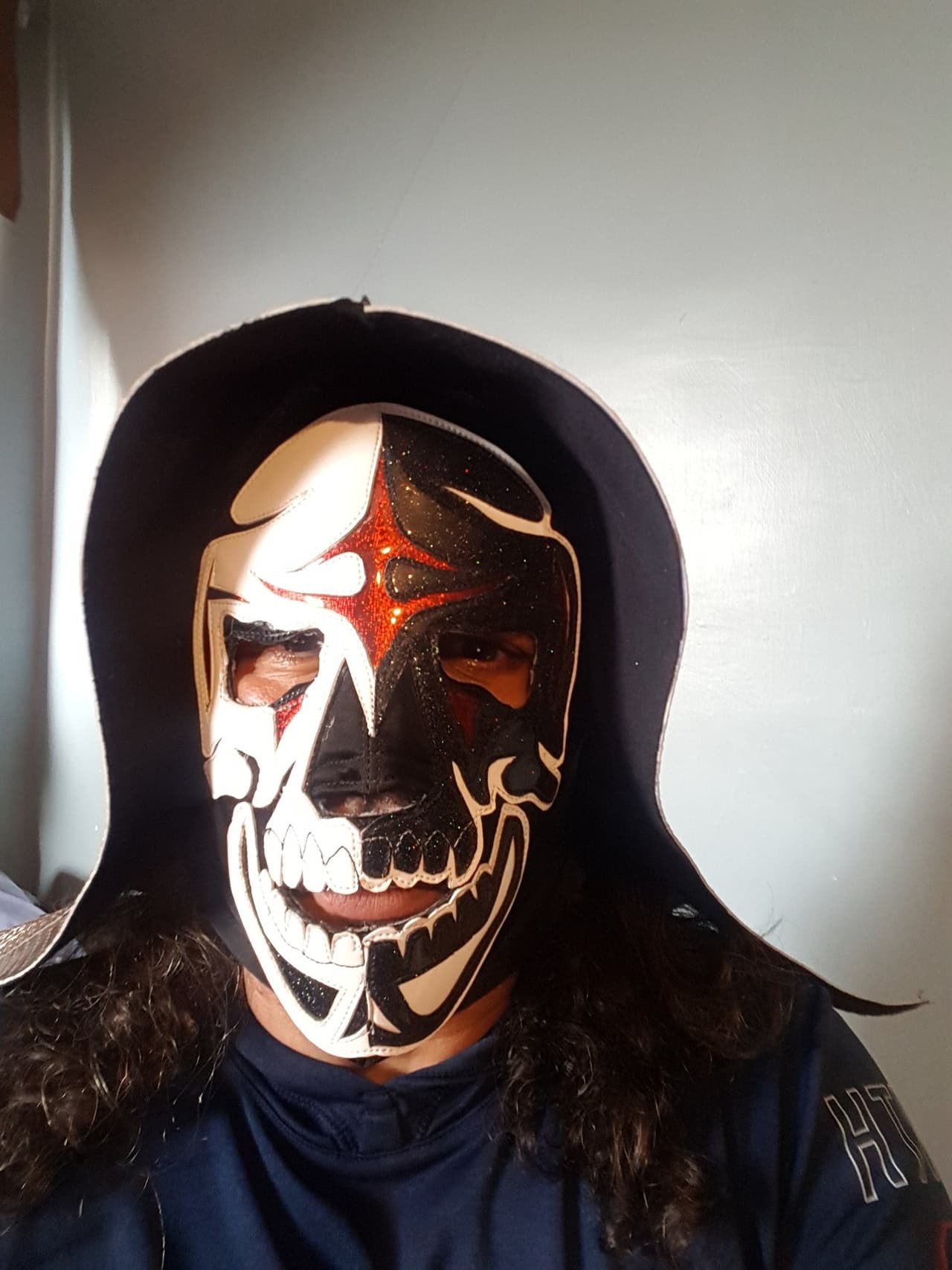 Si la insuficiencia renal no es tratada de emergencia y con cuidados intensivos puede ser fatal, cómo sucedió en el caso de
<b>La Parka</b>.