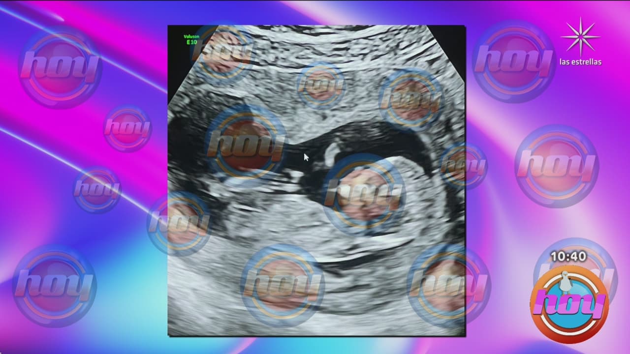 Así luce el primer bebé de Paul Stanley