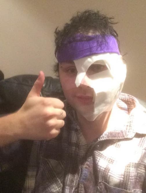 Afortunadamente todo está bien y el joven tomó todo con sentido del humor. En sus redes sociales publicó el siguiente mensaje "Me siento mucho mejor y mi cara está bien :) Ansioso por el show de hoy”.