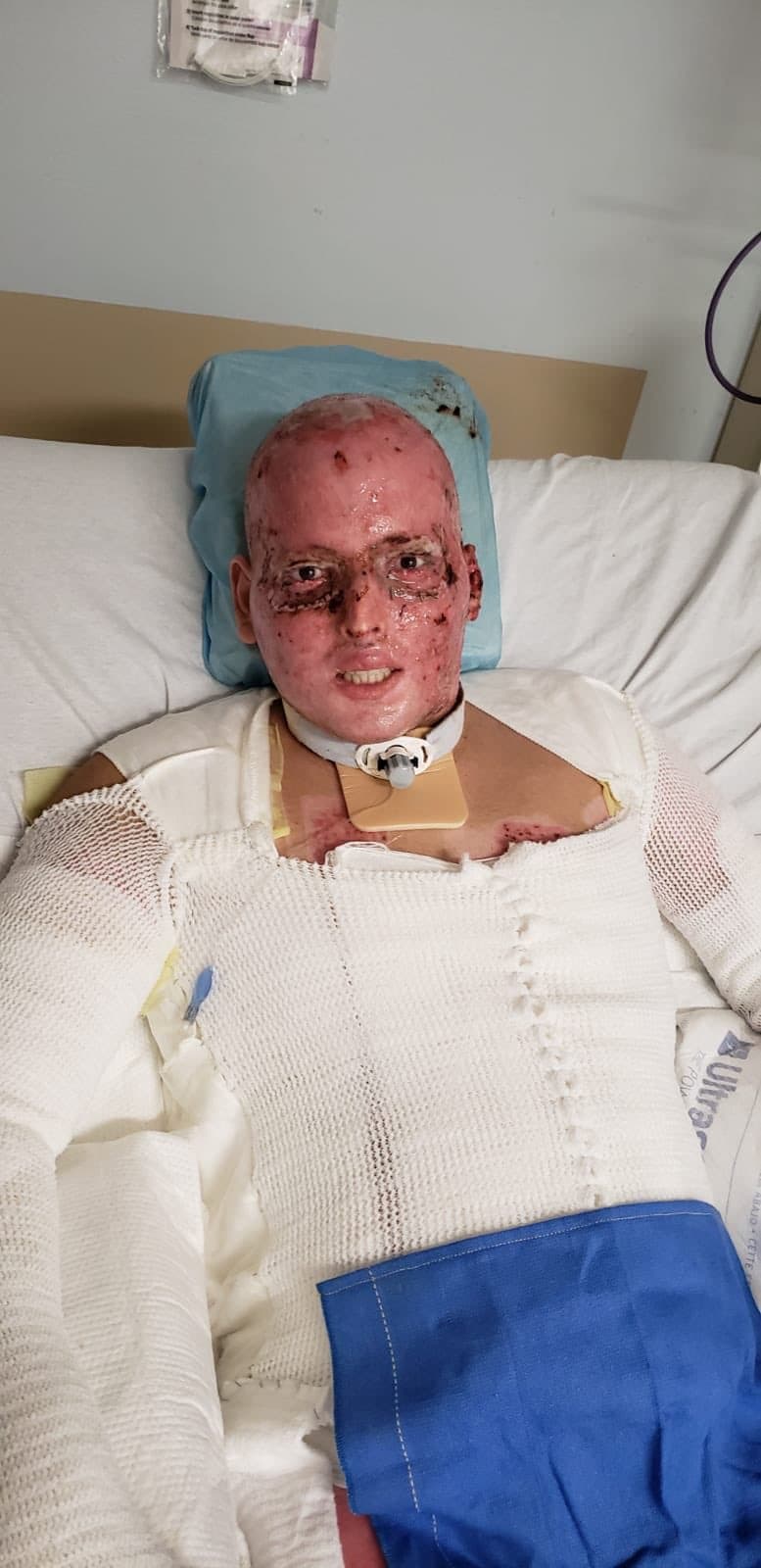 Aunado a su problema de salud, el prolongado proceso de recuperación le dejó una deuda con el gobierno de EEUU de unos 1.7 millones de dólares, luego de que su aseguradora se negara a cubrirlo. Sin embargo, tras otra férrea lucha -ahora con el Depatamento de Tesoro- Hernández pudo conseguir que se le perdonara dicho monto. “Hoy es momento de concentrarme en mí”, dijo en su momento. 
<br>