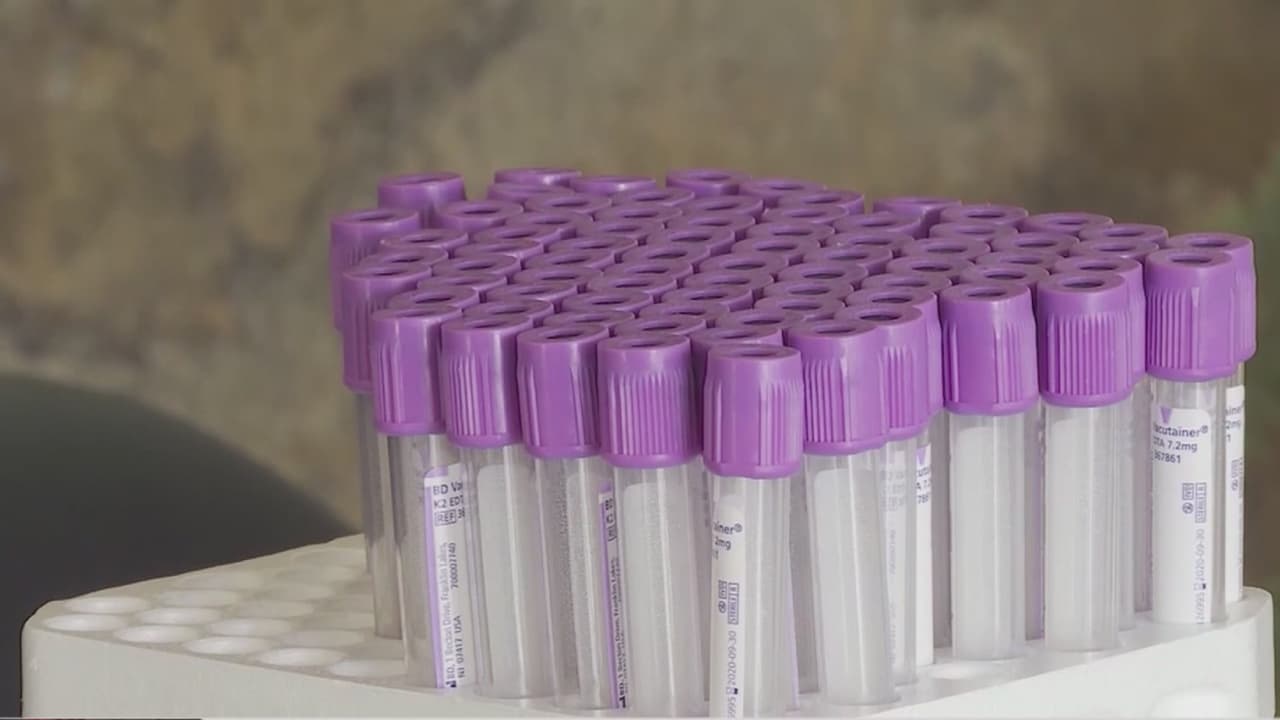 Habilitan centro de pruebas para detectar el coronavirus en el barrio de Las Empacadoras