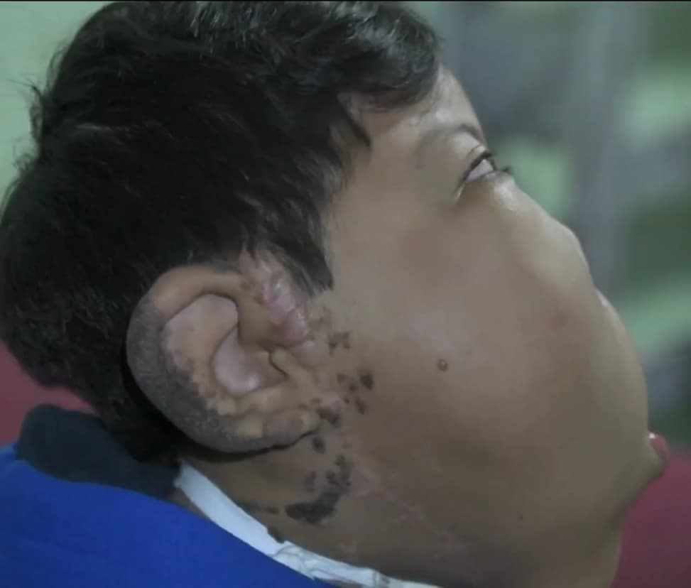 Desde el nacimiento del niño, la afligida madre ha tenido que prepararse para lo peor, sobre todo cuando Moisés 
<b>comenzó a padecer distintos problemas médicos que pusieron en riesgo su vida. </b>
<br>